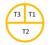 Bild 3: Schematisches Beispiel für die Zeiteinteilung mit der Pie-Chart-Agenda